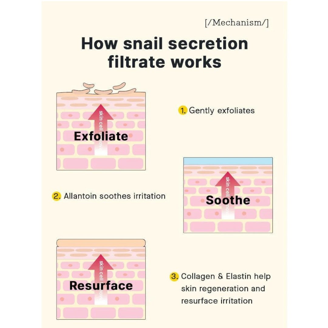 cream for acne skin | vgle