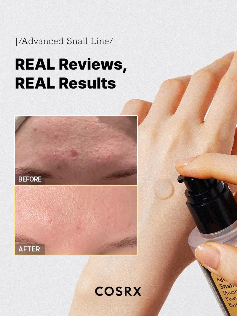 COSRX - Advanced Snail 96 Mucin Power Essence – 100ml – Skin Care | Korean Skincare Canada - VGLE