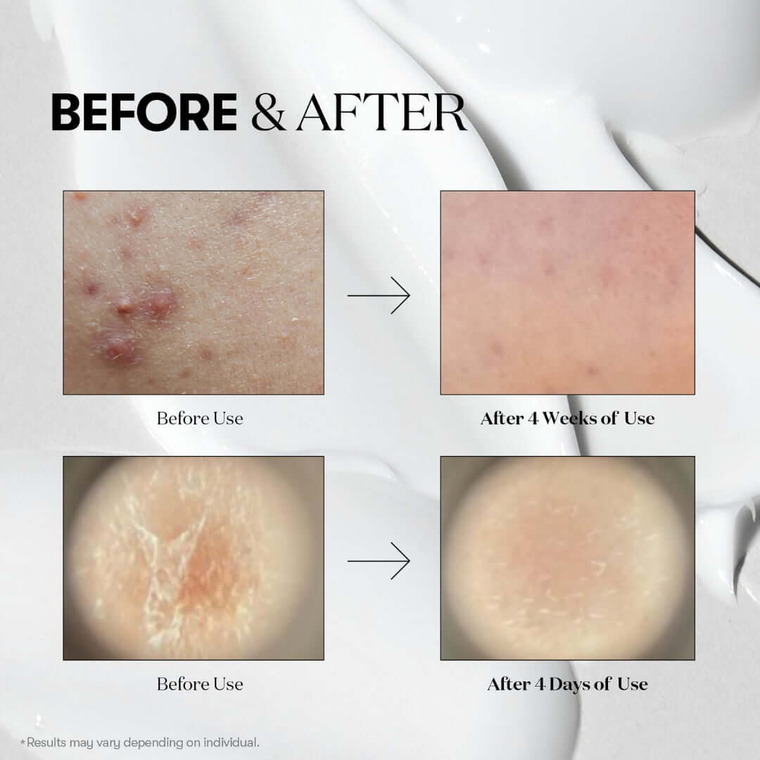 VGLE Bundle - Texture Reset Combo – Bundles | Korean Skincare Canada - VGLE