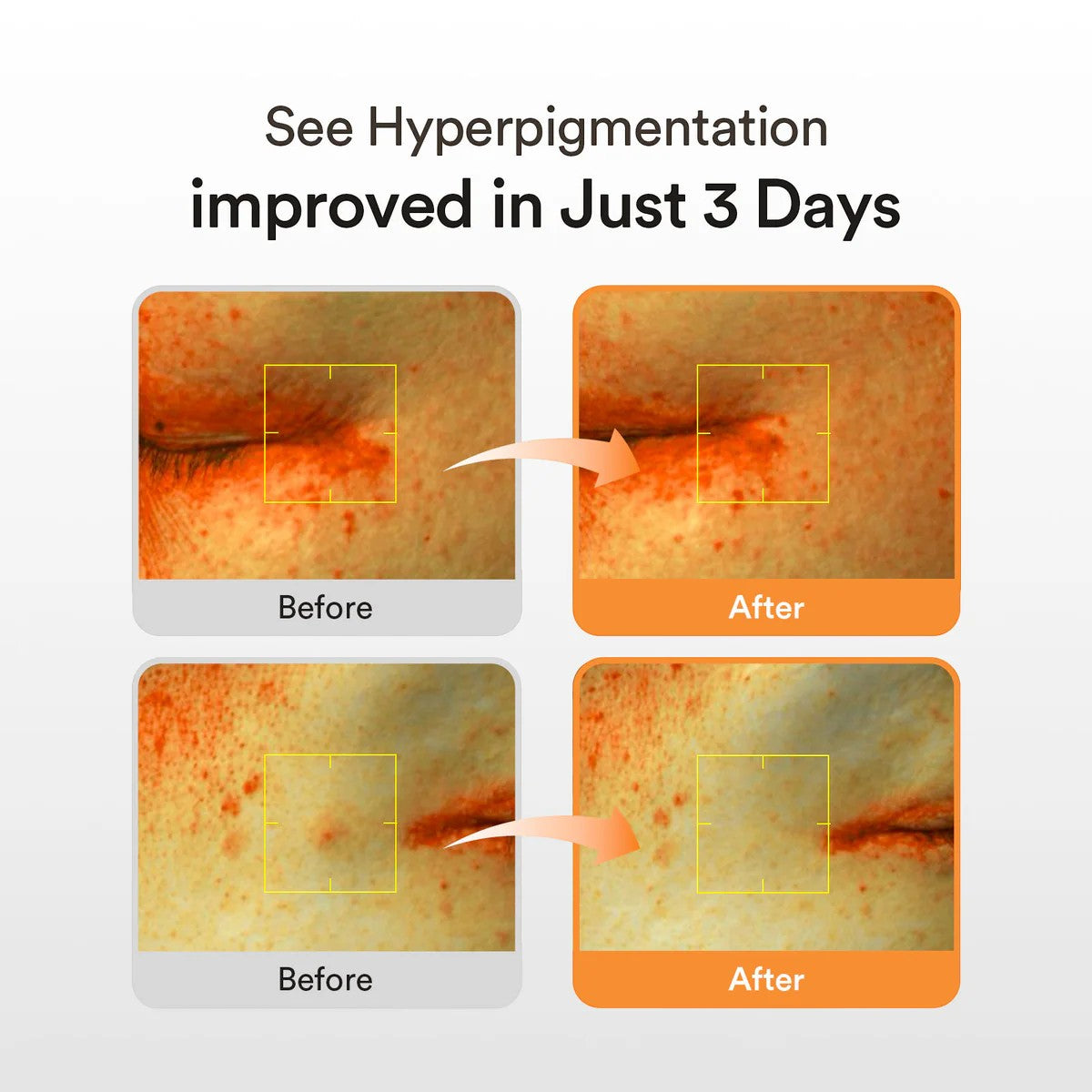 Abib Glutathiosome Spotless glow Duo Abib