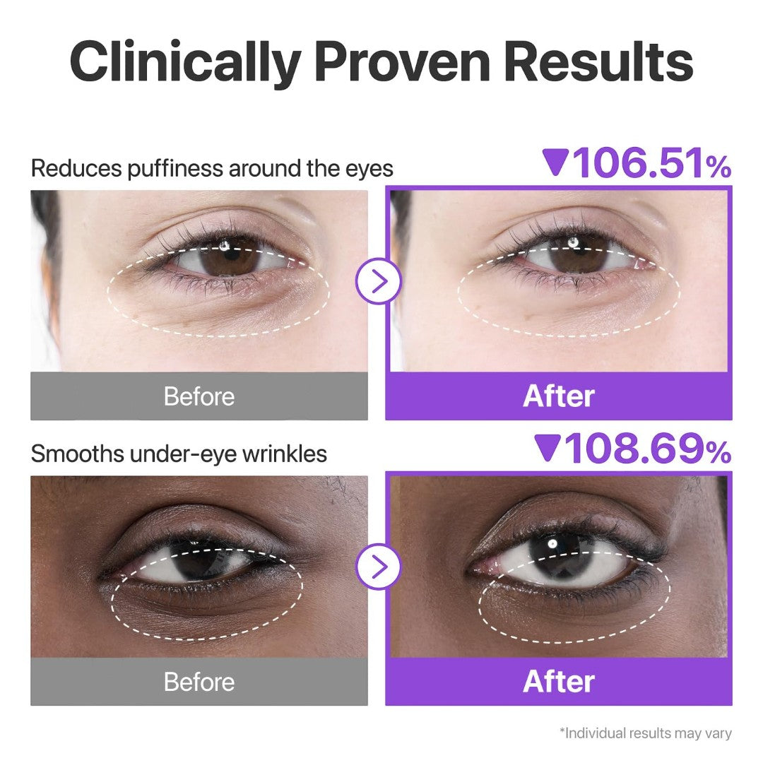 numbuzin No.9 NAD+ Collagen Under Eye Patches 5EA numbuzin