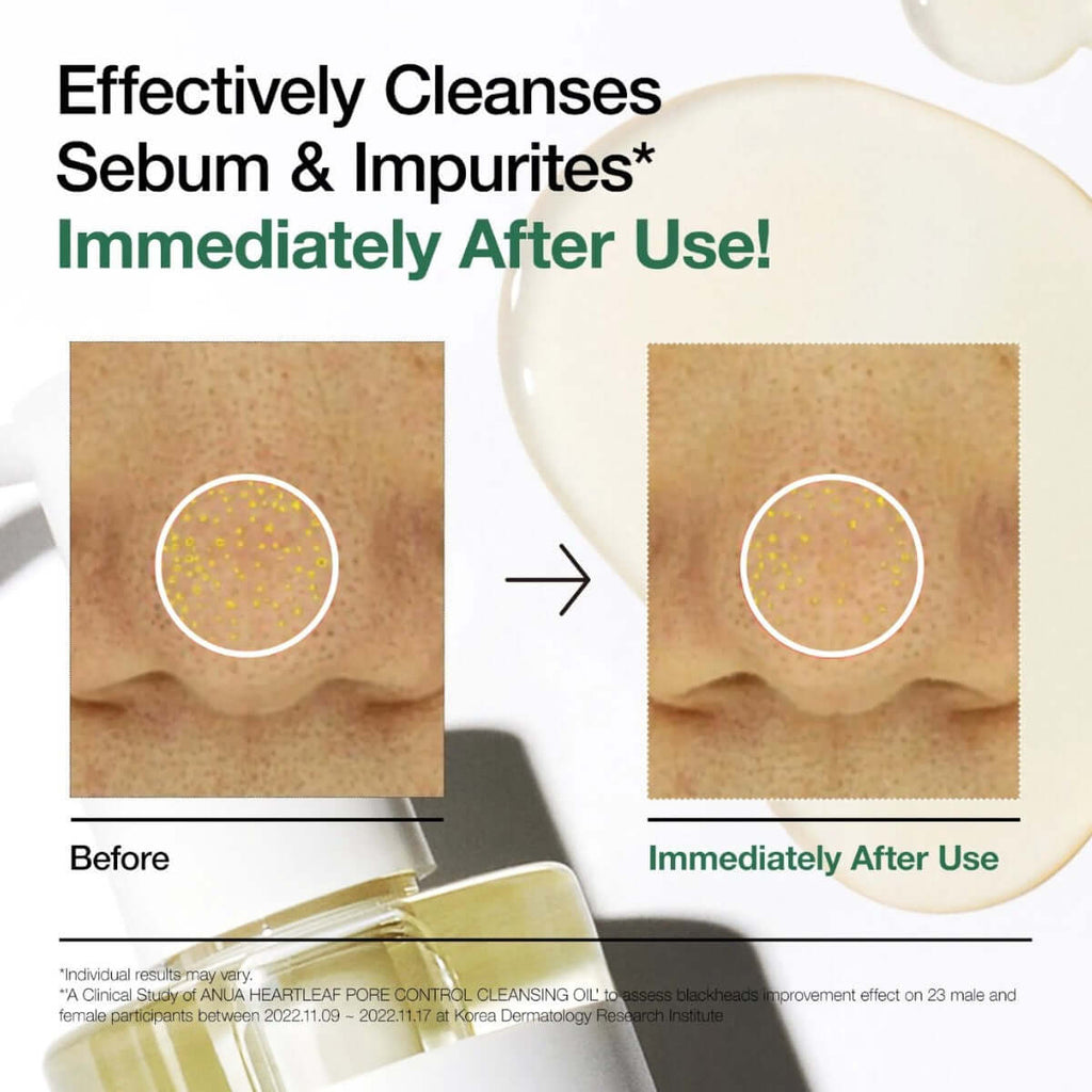 Before and after results of Anua Heartleaf Pore Control Cleansing Oil showing sebum and impurities effectively cleansed.