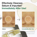 Before and after results of Anua Heartleaf Pore Control Cleansing Oil showing sebum and impurities effectively cleansed.