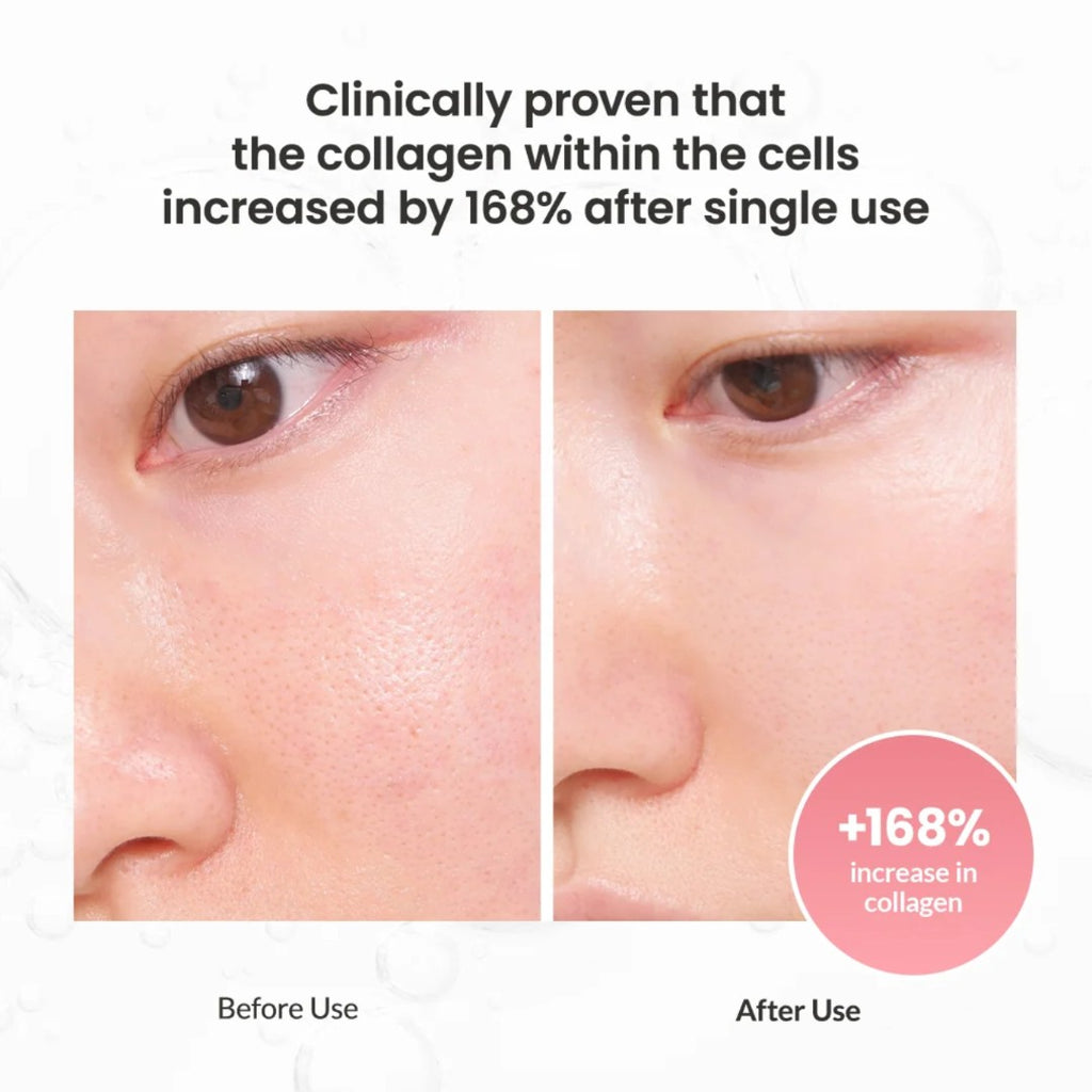 Before and after comparison of increase in collagen +168 after single use biodance serum