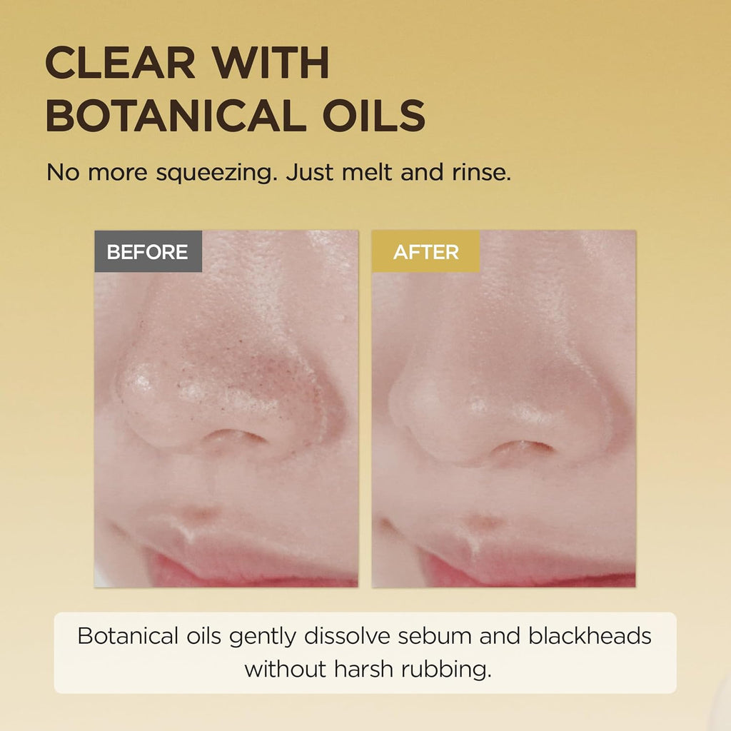 Before and after comparison of a nose with text about botanical oils溶解sebum and blackheads.