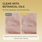 Before and after comparison of a nose with text about botanical oils溶解sebum and blackheads.