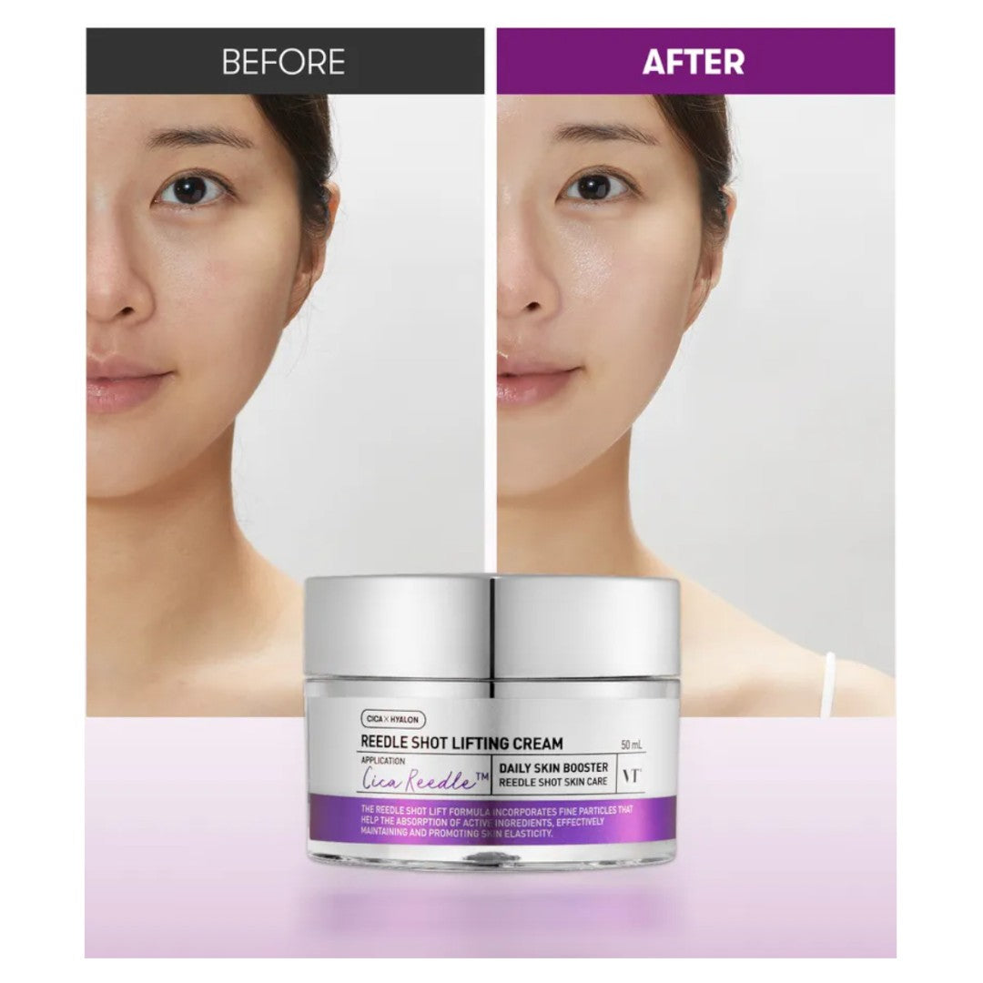 VT Reedle Shot Lifting Cream 50ml VT COSMETIC