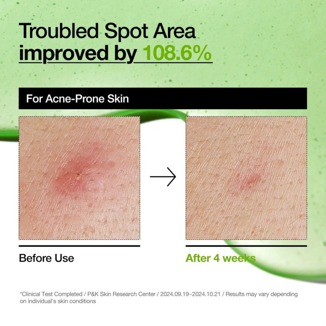 Anua Azelaic Acid 10 Hyaluron Redness Soothing Serum 30ml – Skin Care | Korean Skincare Canada - VGLE