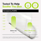 Anua Ultra Thin Spot Cover Patch 75ea Anua