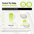 Anua Ultra Thin Spot Cover Patch 75ea Anua