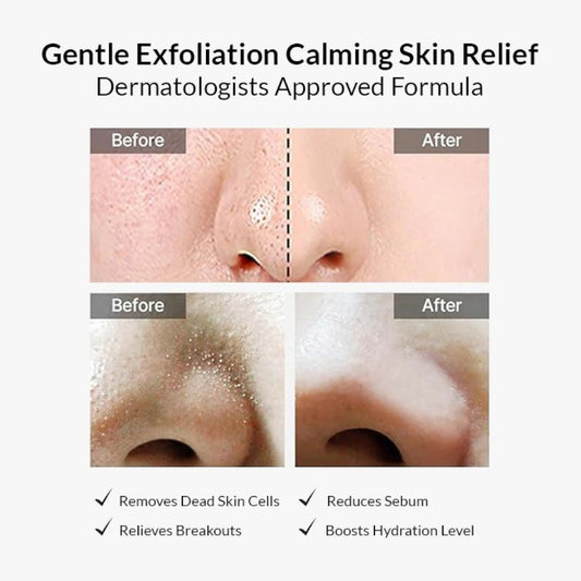 celimax Ji Woo Gae Heartleaf BHA Peeling Pad 125ml / 60pads – Skin Care | Korean Skincare Canada - VGLE