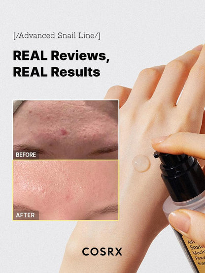 COSRX - Advanced Snail 96 Mucin Power Essence – 100ml – Skin Care | Korean Skincare Canada - VGLE