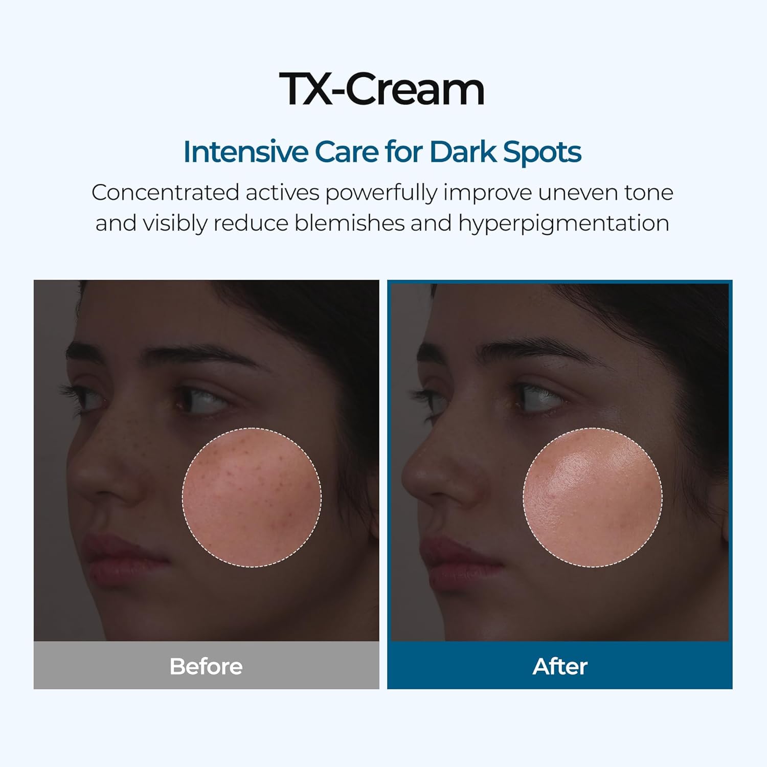 Dr.Melaun TX Cream 50ml Dr.Melaun
