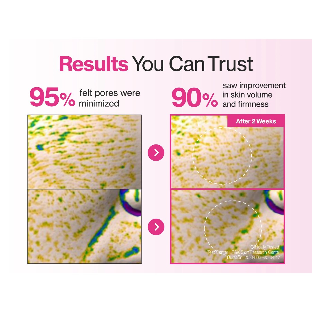 numbuzin No.2 Rose PDRN Overnight Collagen Mask 4pcs numbuzin