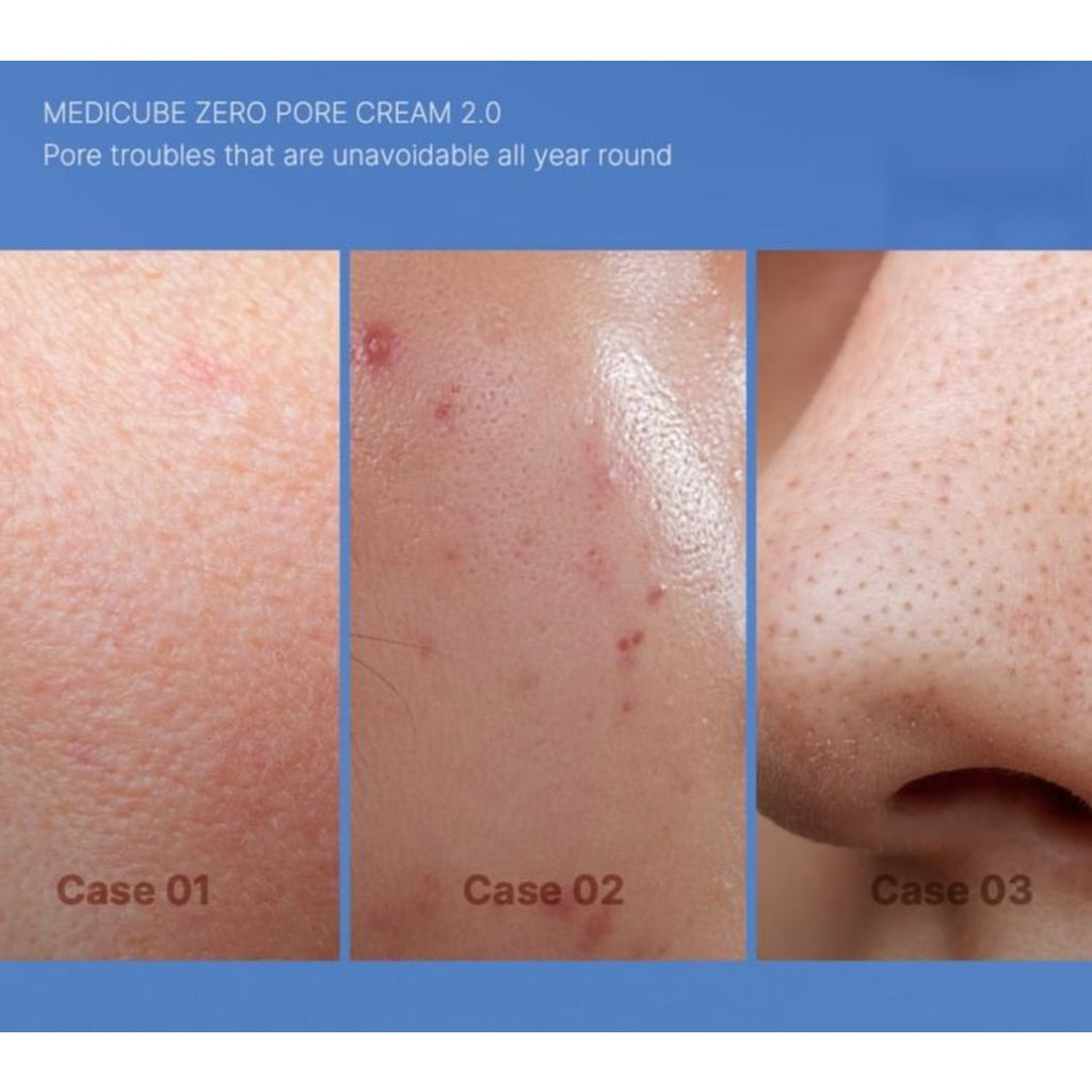 medicube Zero Pore Cream 2.0 50ml medicube