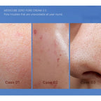 medicube Zero Pore Cream 2.0 50ml medicube