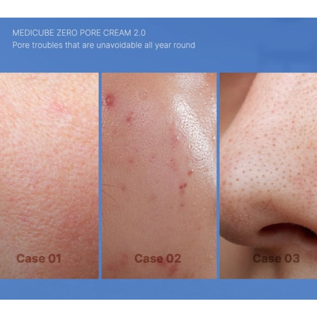 medicube Zero Pore Cream 2.0 50ml medicube