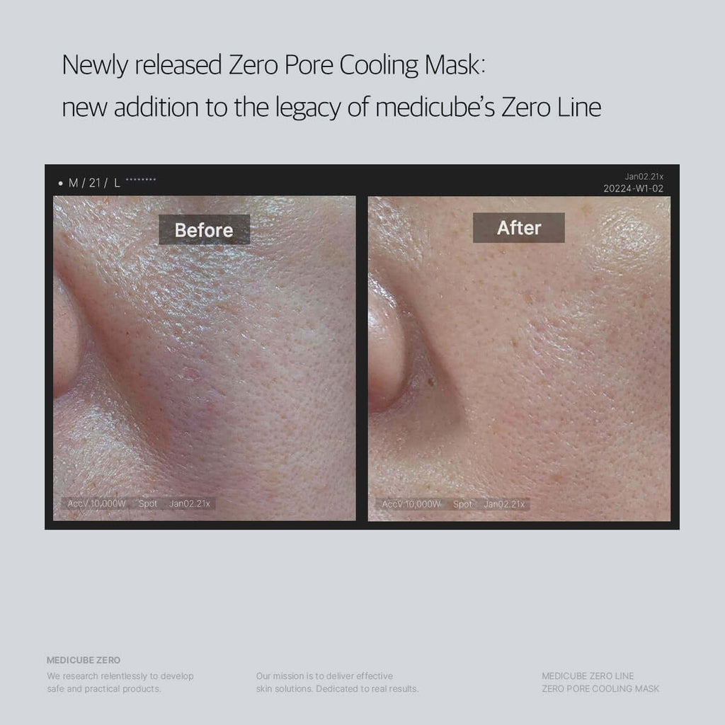Before and after comparison of a Zero Pore Cooling Mask on skin, with text about medicube's Zero Line.