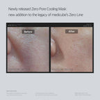 Before and after comparison of a Zero Pore Cooling Mask on skin, with text about medicube's Zero Line.